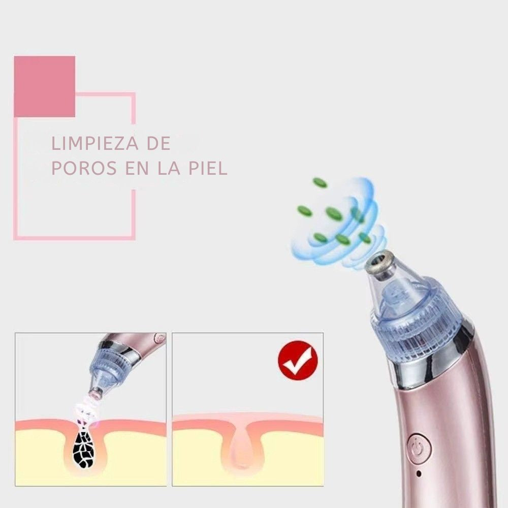 Extractor de Puntos Negros