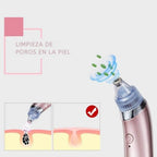 Extractor de Puntos Negros